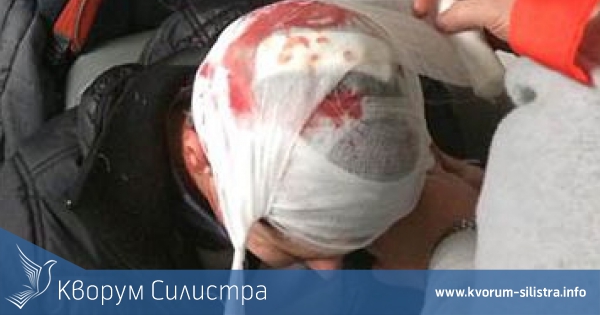 Разбиха главата на 24-годишен в силистренски автосервиз