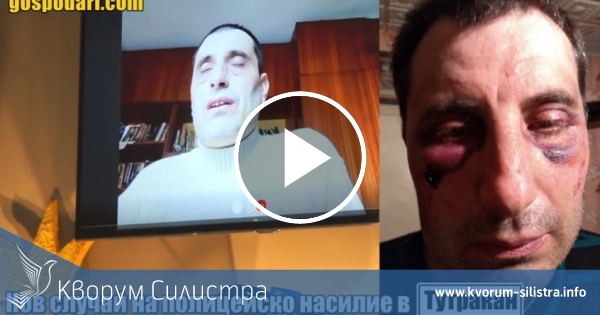 Тутраканец се оплака на Господарите, че е бил бит от полицаи