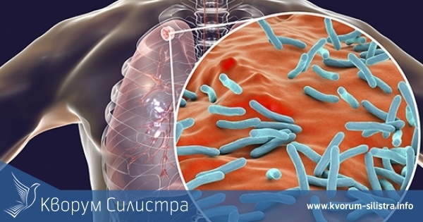 В Силистра заболеваемостта от туберкулоза е над средната за страната