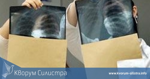 Двама с туберкулоза открити за седмица в Силистренско