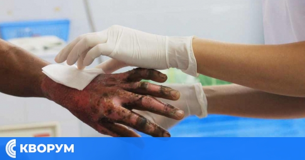 Инцидент с газова бутилка в Тутракан: Мъж с изгаряния по ръцете