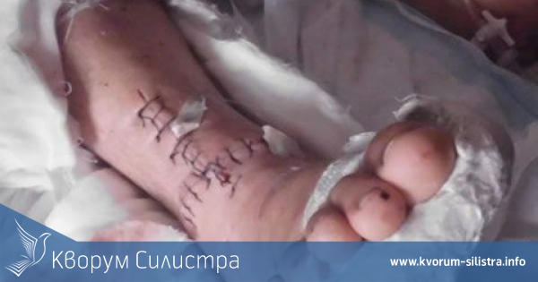 Зачестяват травмите след падания на леда