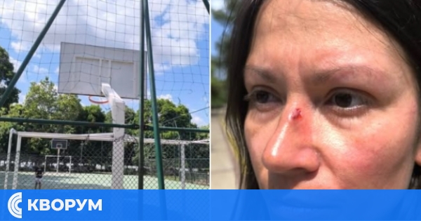 Жена пострада от хвърлена топка на детска площадка в Дунавския парк – Силистра