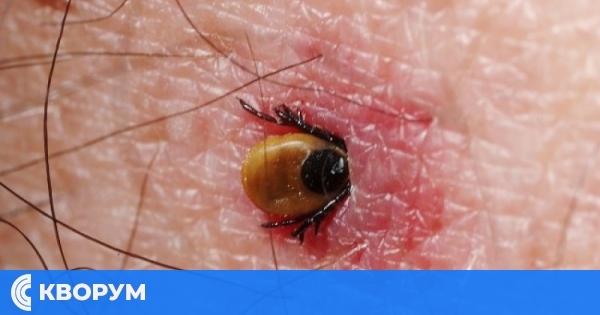 РЗИ: Потвърден случай на Марсилска треска в Силистренско