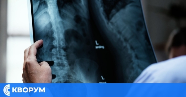 България срещу "тихата епидемия": Над 420 000 души страдат от остеопороза