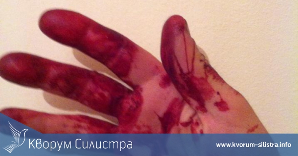 15 бездомни кучета обезобразиха млад мъж в Силистра