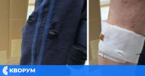 Напрежение в Тутракан: Втори случай на нахапан от бездомни кучета за седмица, медиците излязоха с протестно писмо до кмета