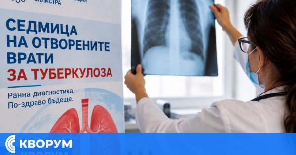 119 души са изследвани за туберкулоза по време на "Седмицата на отворените врати" в Силистра